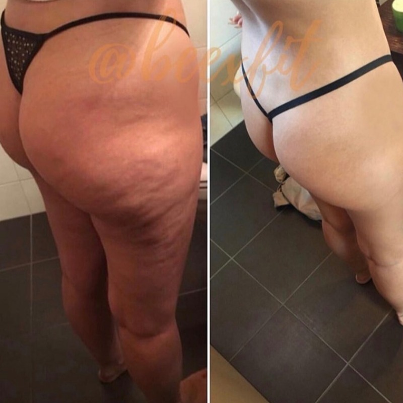 Transformation avant / après d'un membre Beexfit