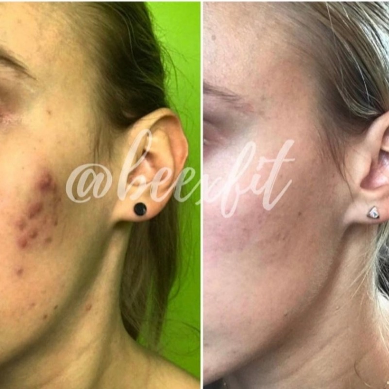 Transformation avant / après d'un membre Beexfit